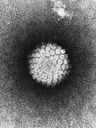 HPV 바이러스의 실제 모습 (TEM 촬영)